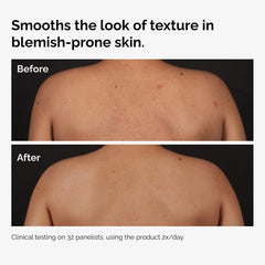 Salicylic Acid 0.5% Body Serum