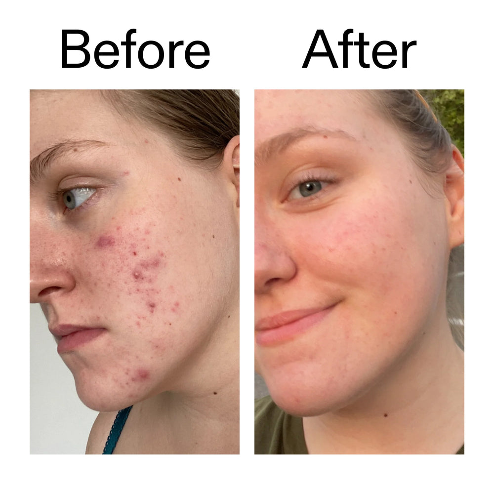 15% Vitamin C + EGF Serum