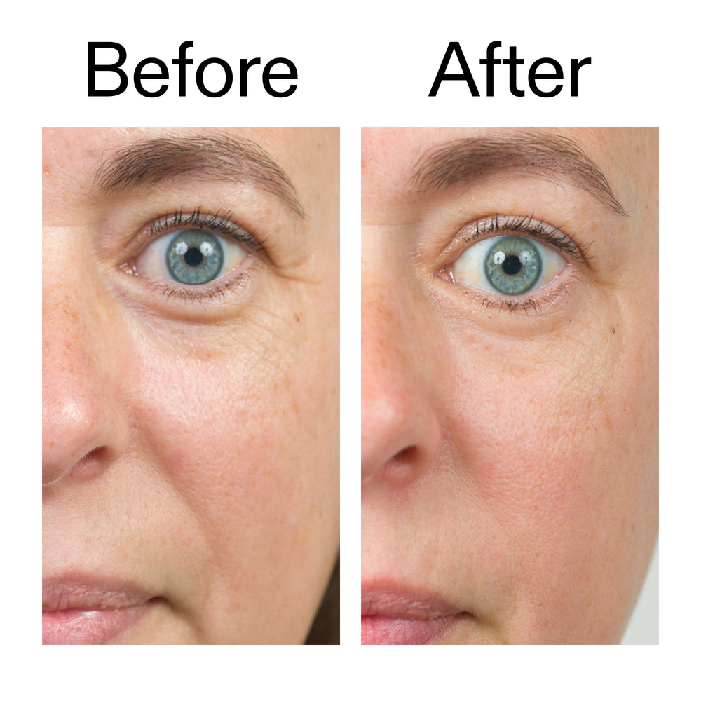 Bio-Active Ceramide Moisturiser