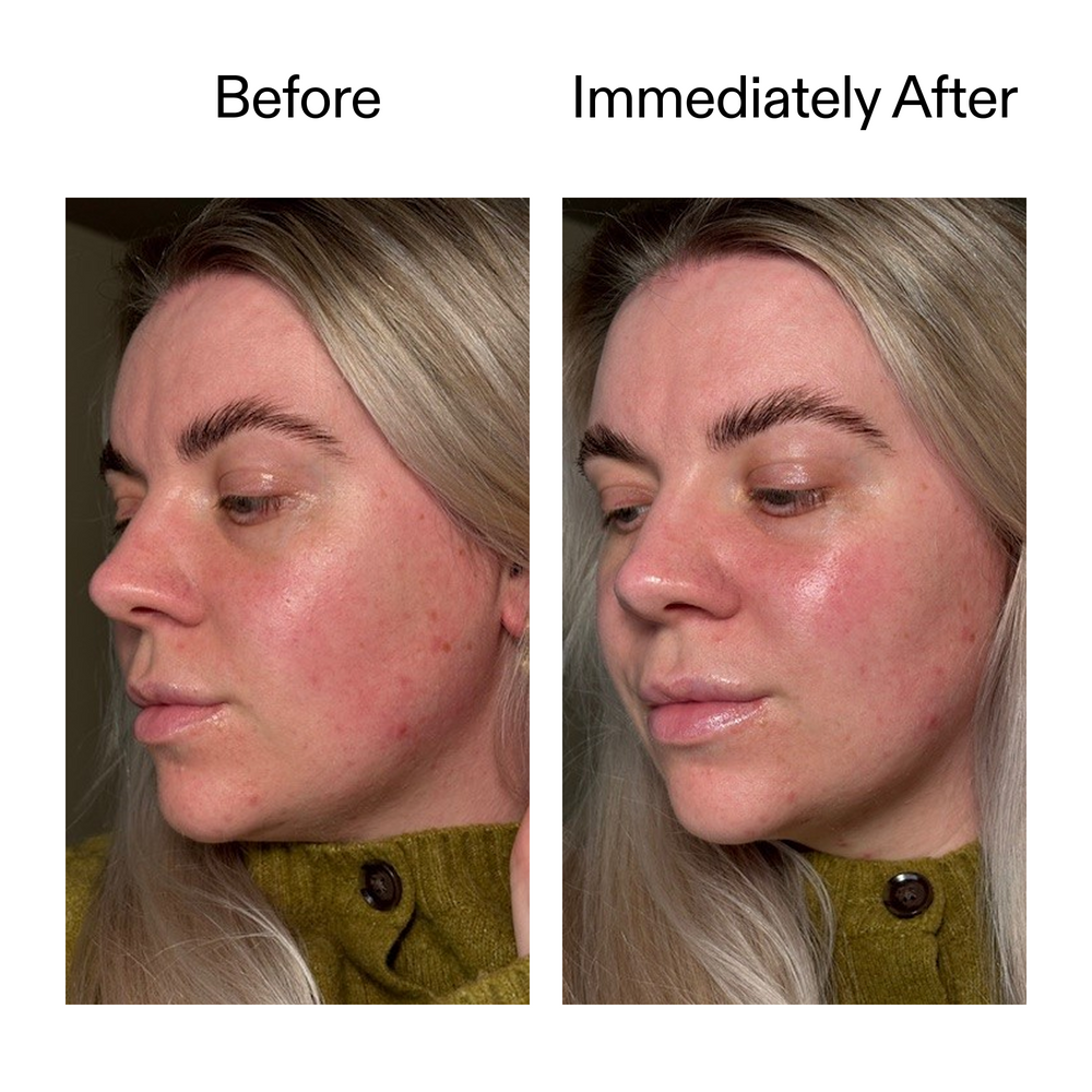 Exosome Glow Serum