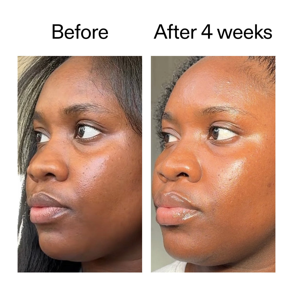 Exosome Glow Serum