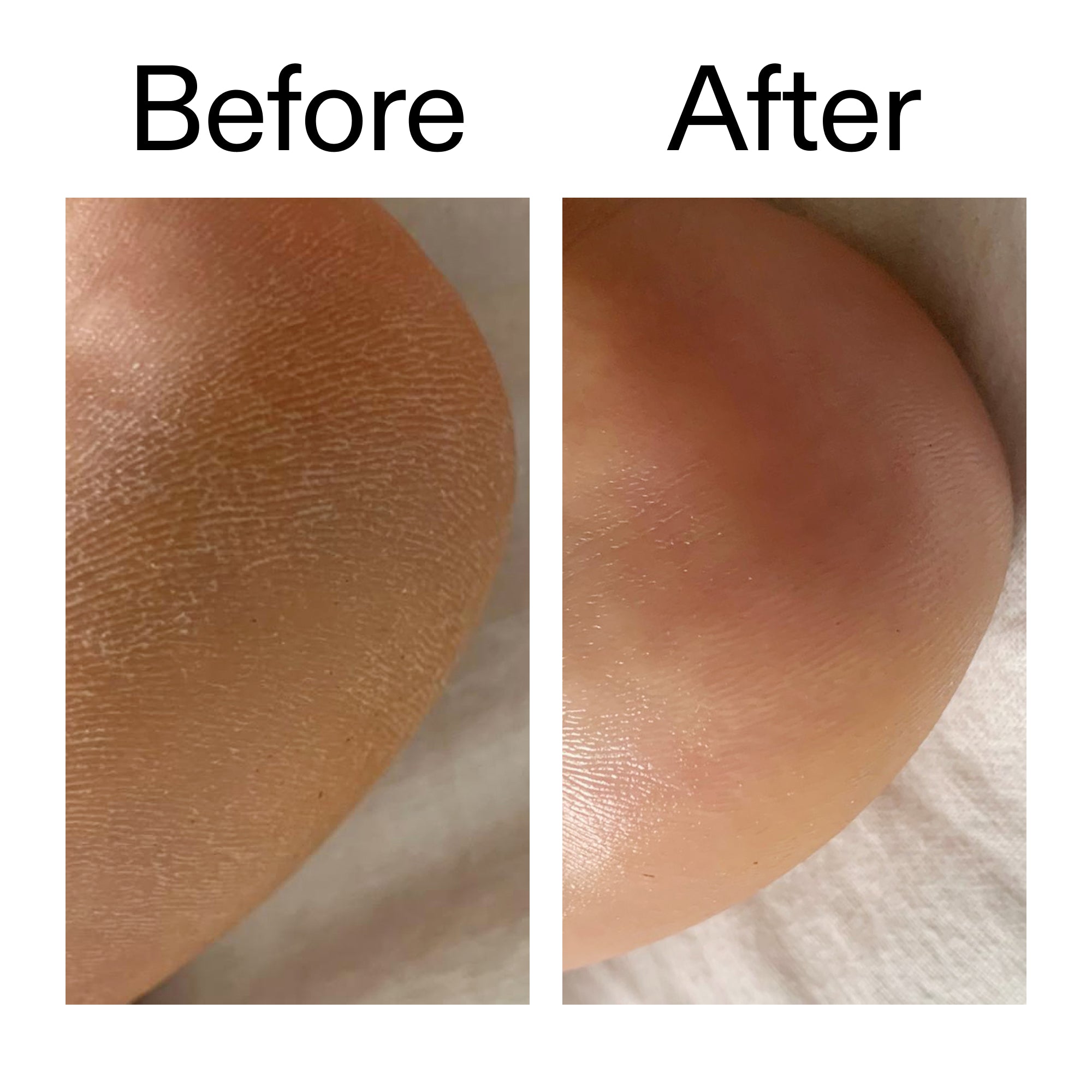 Glycolic Acid Exfoliating Body Stick