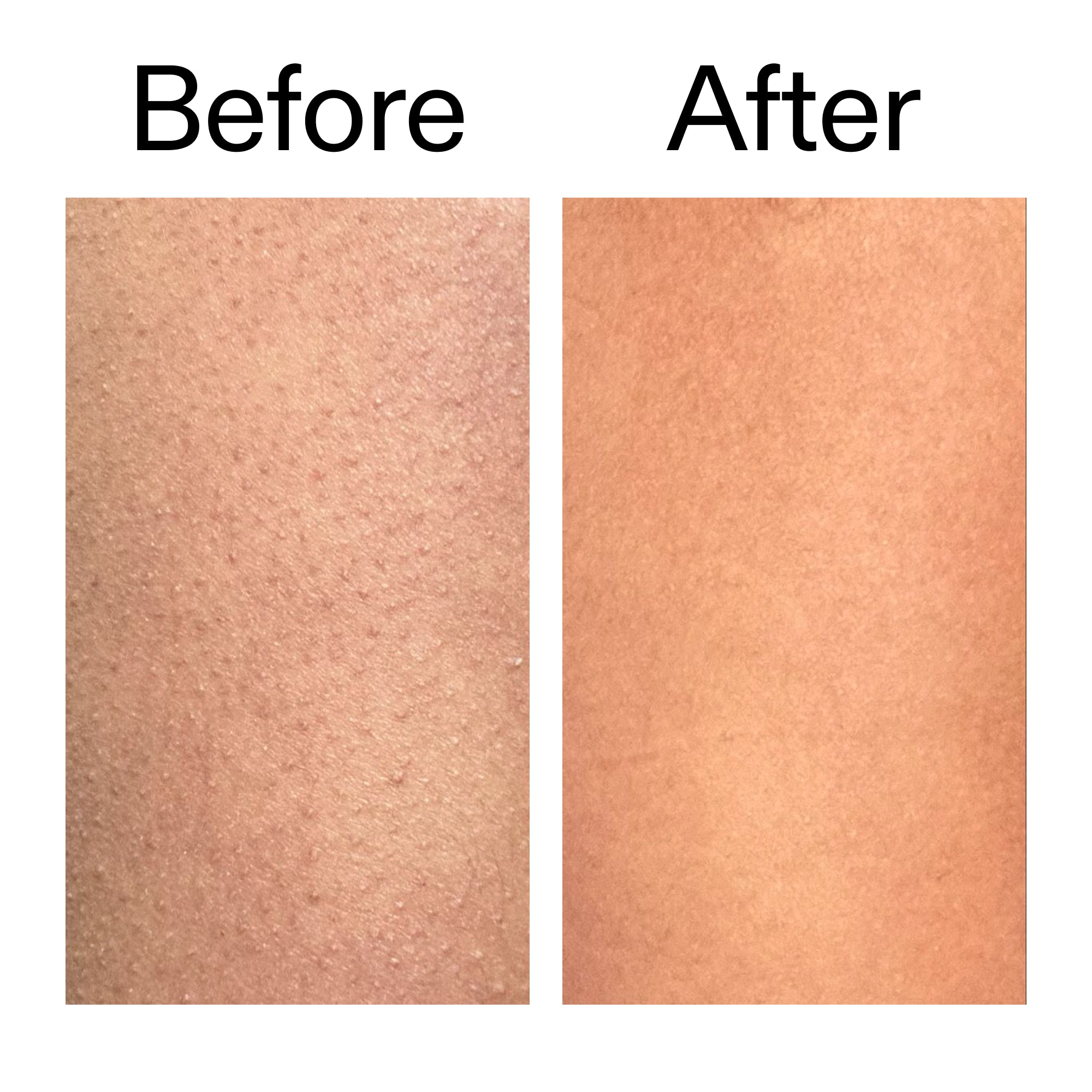 Glycolic Acid Exfoliating Body Stick