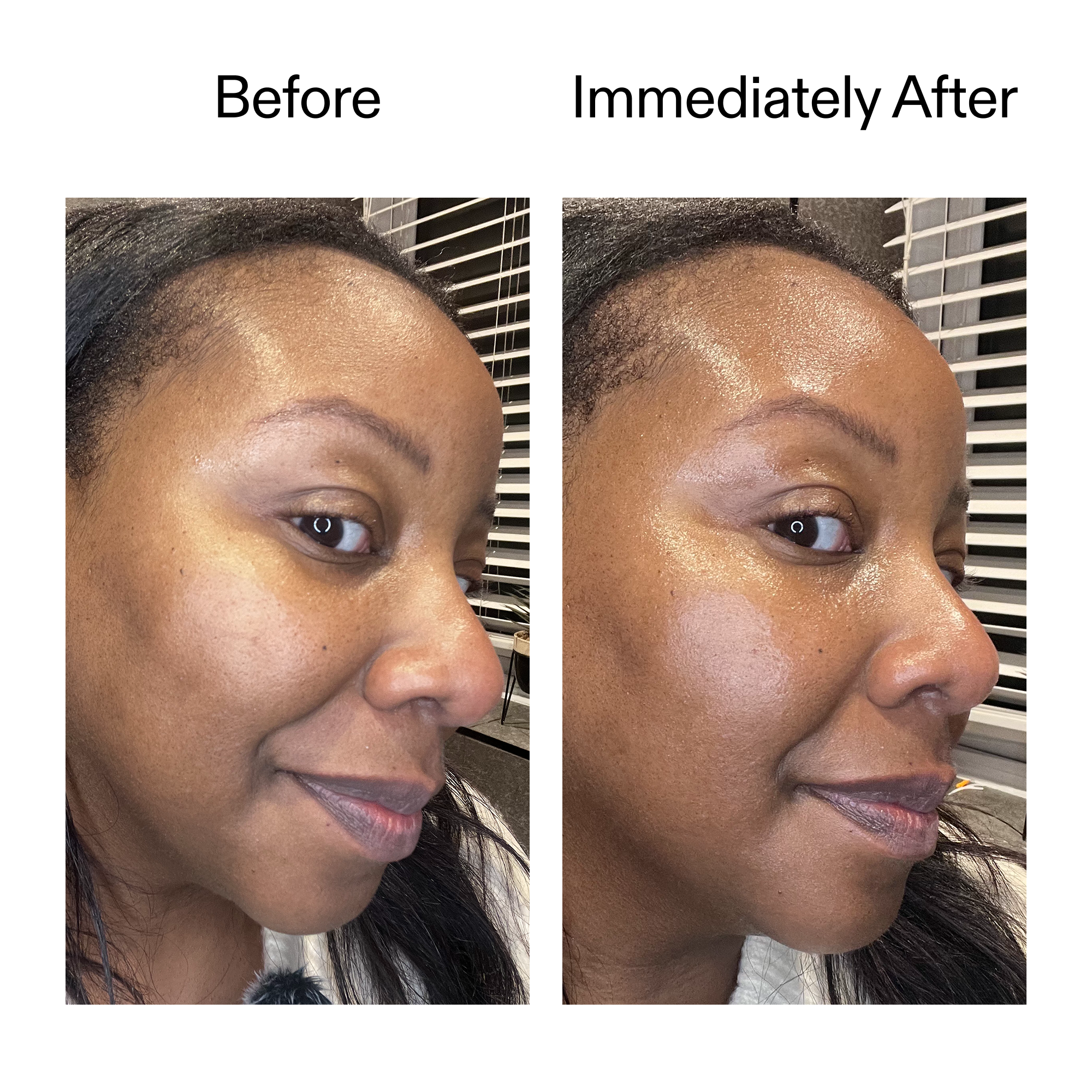 Exosome Glow Serum
