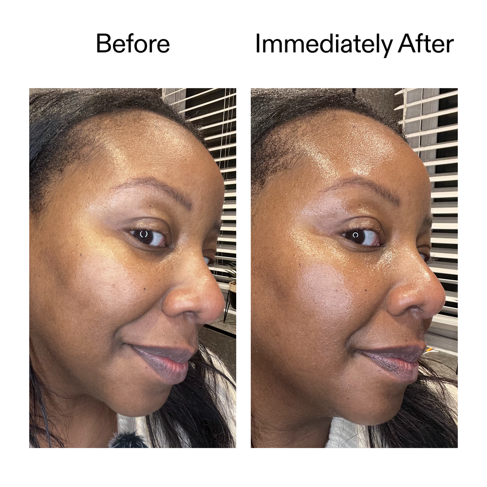 Exosome Glow Serum