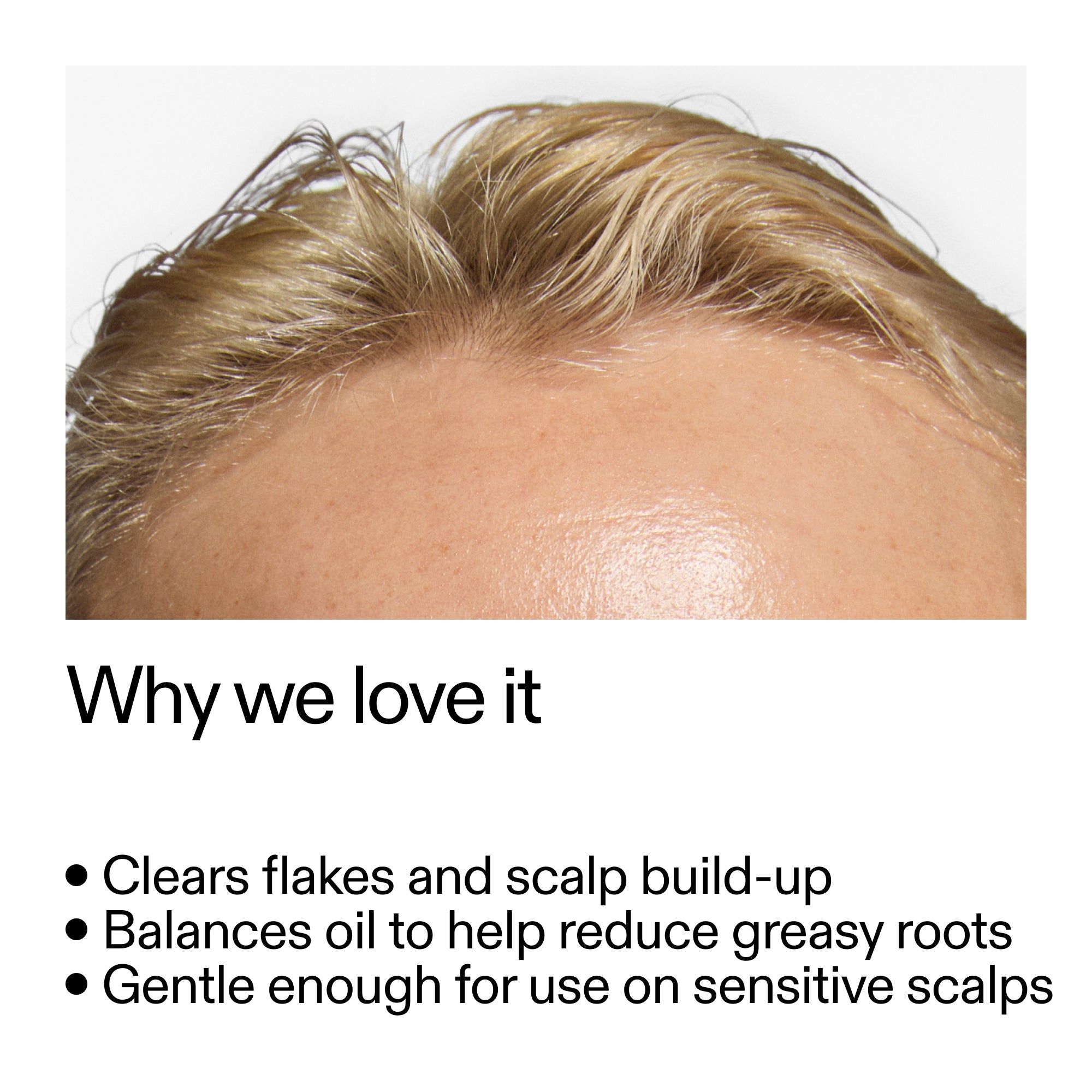 Salicylic Acid Exfoliating Scalp Treatment